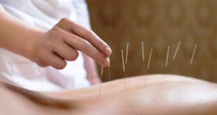 Jenis Terapi Akupuntur Medik di Efje Klinik yang Sudah Standar WHO