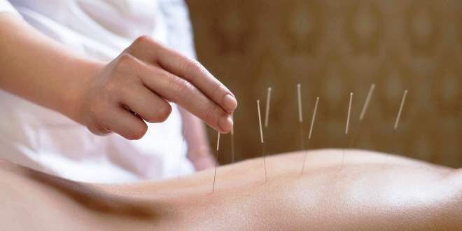 Jenis Terapi Akupuntur Medik di Efje Klinik yang Sudah Standar WHO