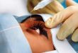Mengenal Operasi LASIK, Solusi Efektif untuk Mata Minus dan Plus Tanpa Ribet Pakai Kacamata atau Softlens