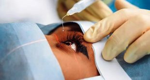 Mengenal Operasi LASIK, Solusi Efektif untuk Mata Minus dan Plus Tanpa Ribet Pakai Kacamata atau Softlens