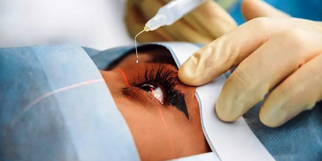 Mengenal Operasi LASIK, Solusi Efektif untuk Mata Minus dan Plus Tanpa Ribet Pakai Kacamata atau Softlens